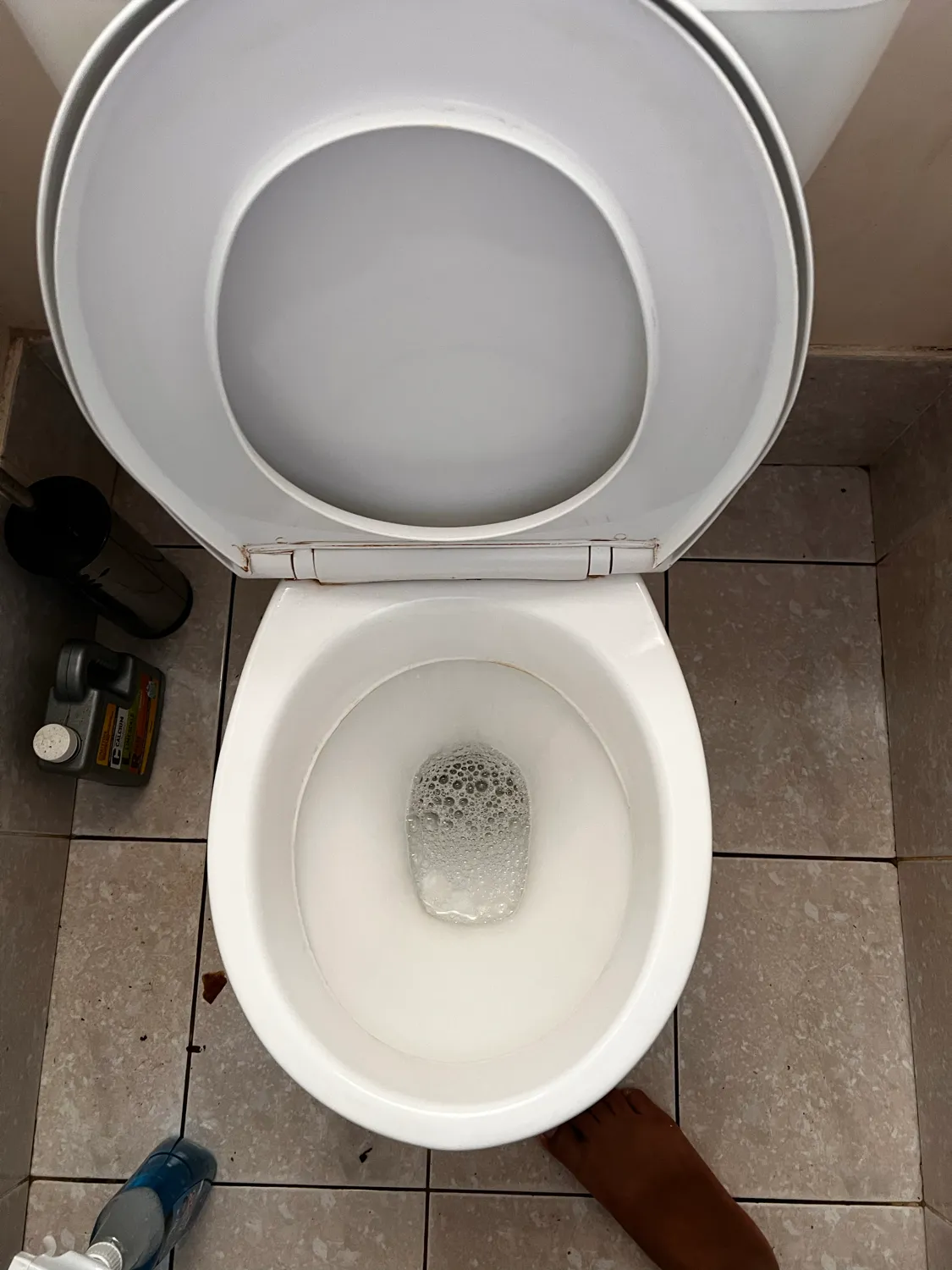 Stained toilet seat after cleaning