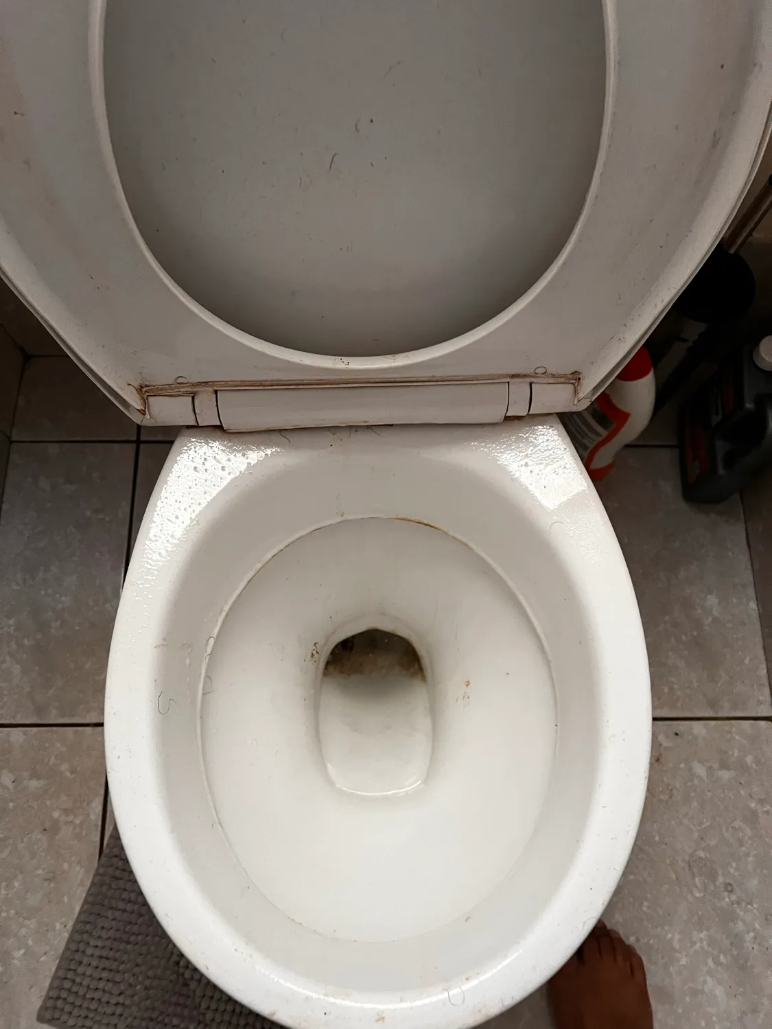 Stained toilet seat before cleaning